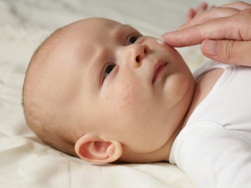 Babys Haut vor dem Austrocknen schützen
