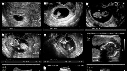 Entwicklung Von Embryofötus Wachstum Im Mutterleib