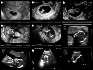 8 Ssw 8 Schwangerschaftswoche Grosse Entwicklung 9monate De