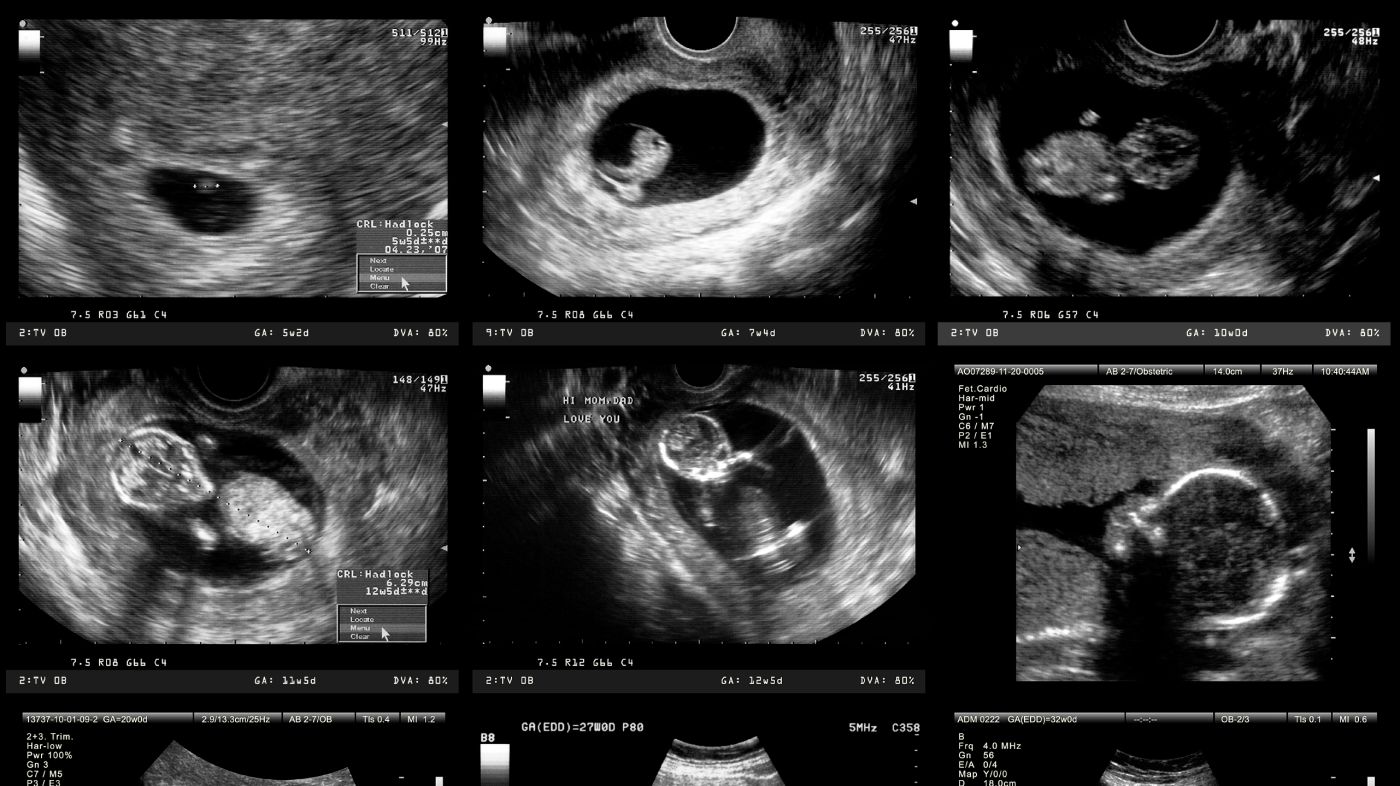 Entwicklung Von Embryo Fotus Wachstum Im Mutterleib 9monate De