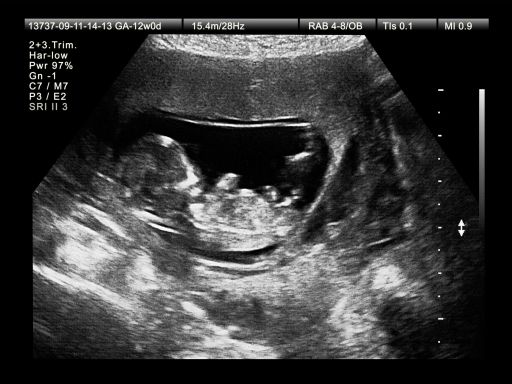 Entwicklung Von Embryo Fotus Wachstum Im Mutterleib 9monate De