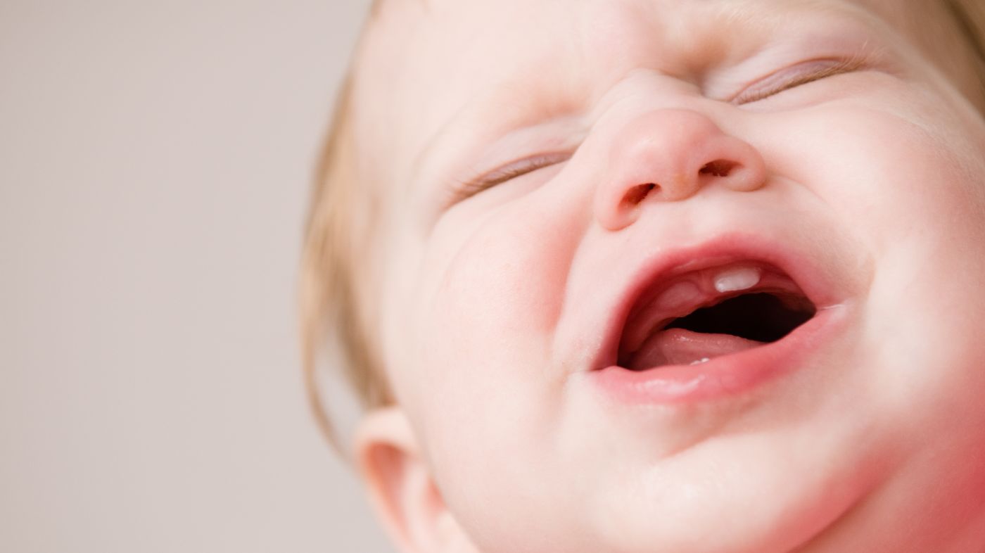 Ausschlag körper zahnen Babyhaut Allergien
