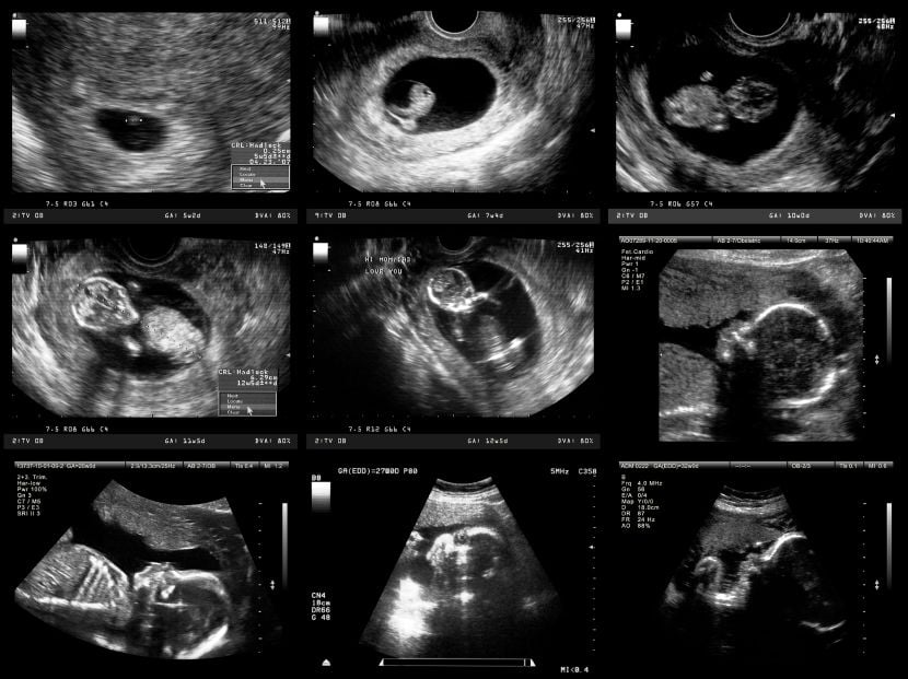 Entwicklung Von Embryo Fotus Wachstum Im Mutterleib 9monate De