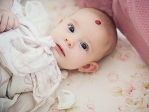 Babyakne Dauer Tipps Zur Gesichtspflege Bei Neugeborenenakne 9monate De